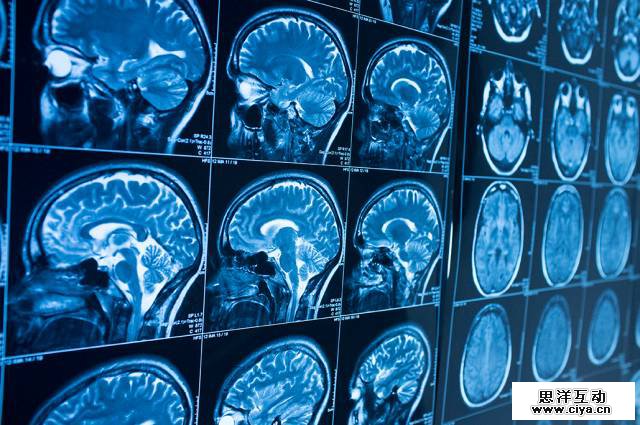 5 家最值得关注的医疗影像数据公司 5 家最值得关注的医疗影像数据公司